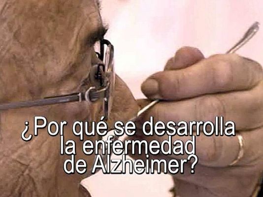 Universo UNED - Por qué se desarrolla el Alzheimer.