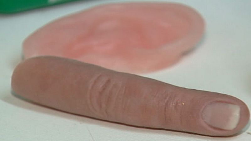 Prótesis que mejoran la calidad de vida | Ver