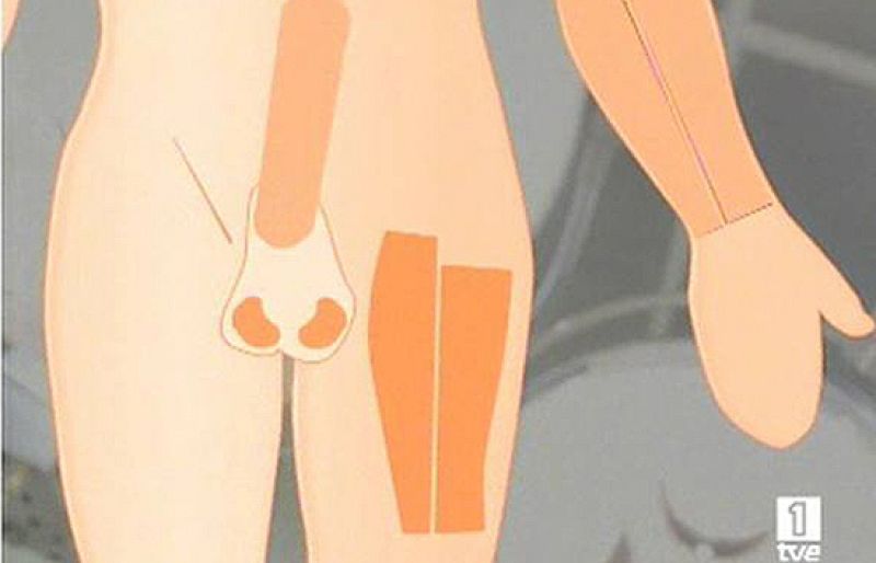 Reconstruyen un pene sensible a un hombre de 26 años - Ciencia y tecnología en Rtve.es | Ver