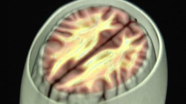 Informe Semanal - La lucha por el recuerdo