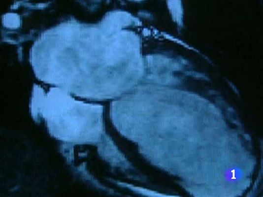 Telediario 1 - Día Mundial del Corazón