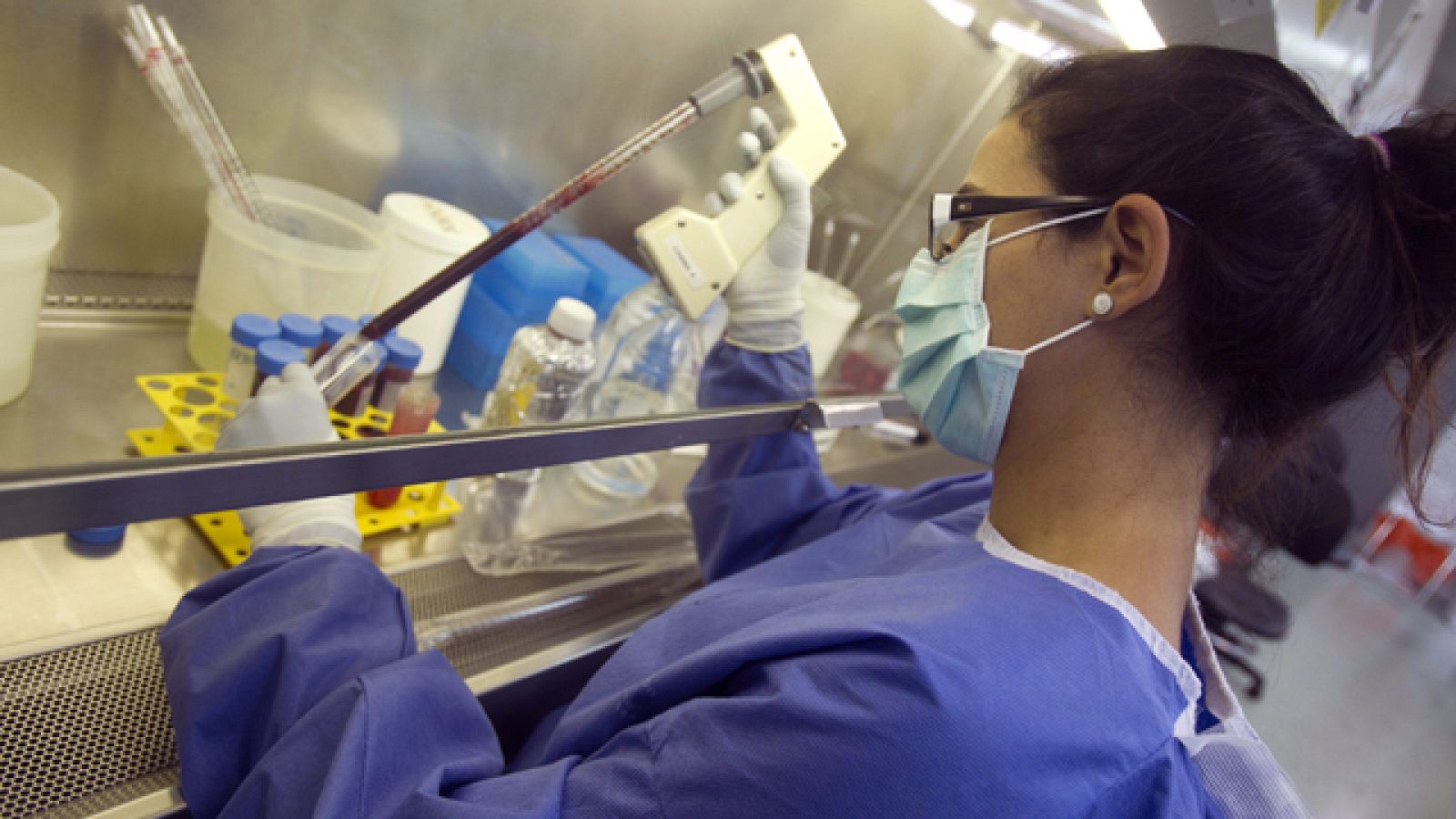 Científicos españoles prueban con éxito en personas sanas una vacuna contra el virus del SIDA