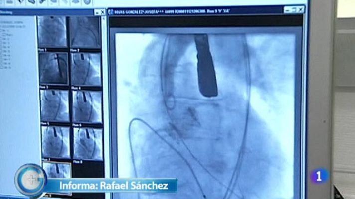 +Gente - Cómo prevenir la muerte súbita