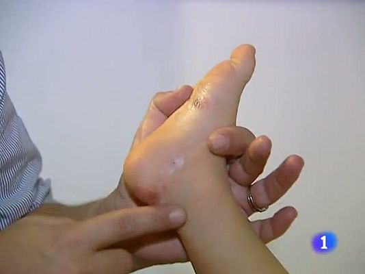 Telediario 1 - La dermatitis atópica, un proceso inflamatorio que desespera a los que la sufren