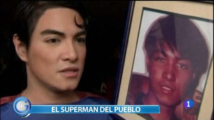 +Gente - Se opera para parecerse a Superman