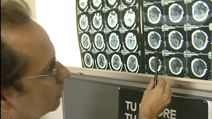 Telediario 1 - Día mundial del ictus