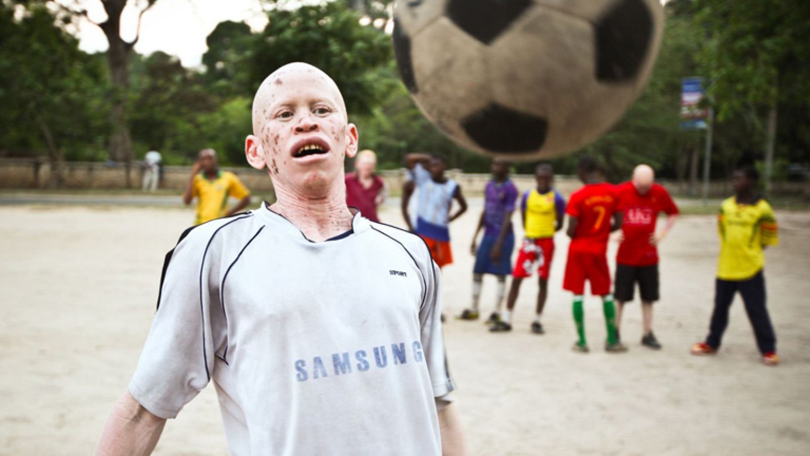 Documentos TV - El club de los albinos - Avance