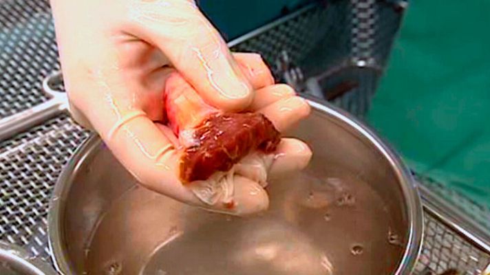 La noche temática - La ciencia del frío - Avance