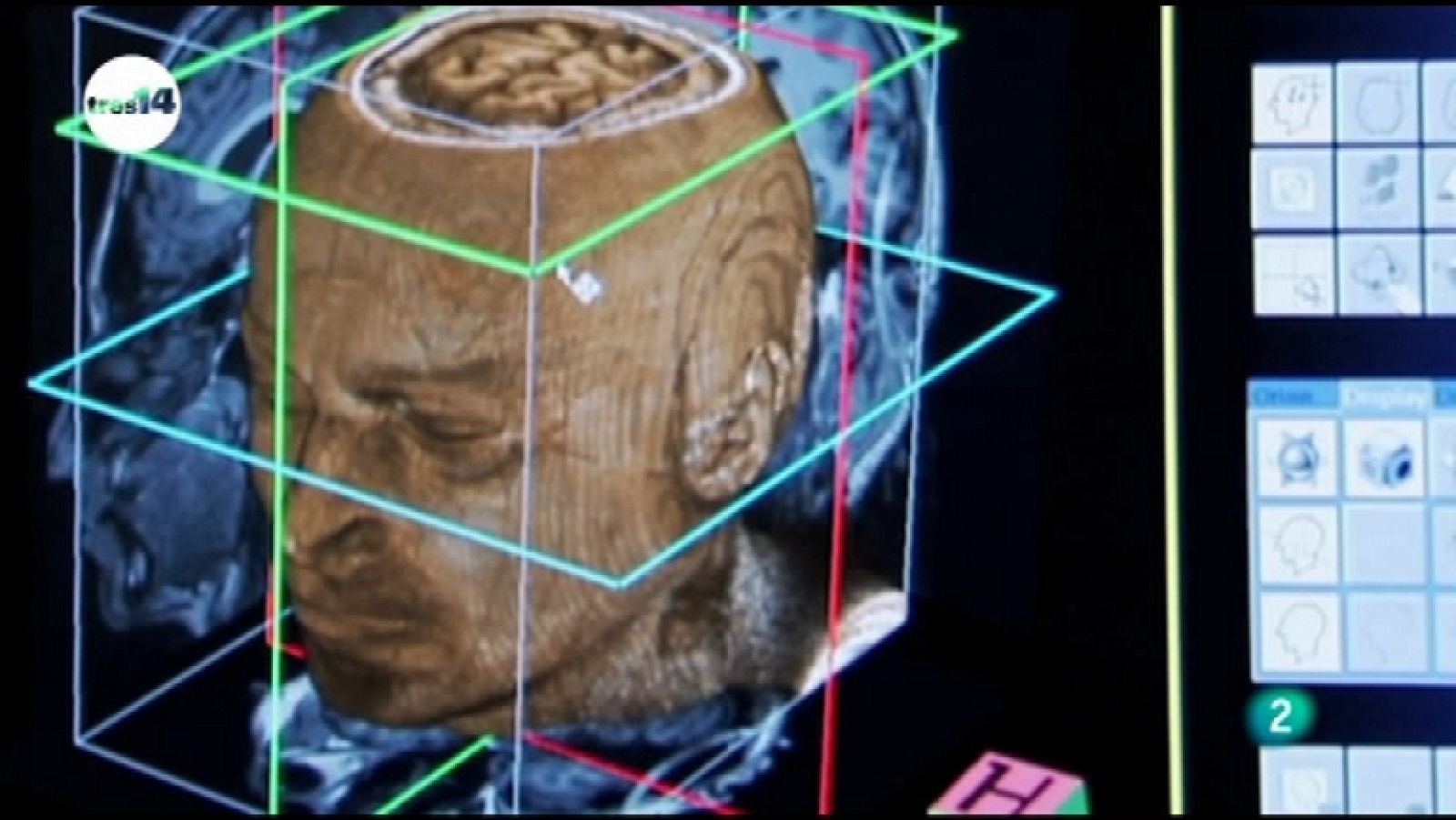 tres14 - Neurolenguaje - Ver ahora