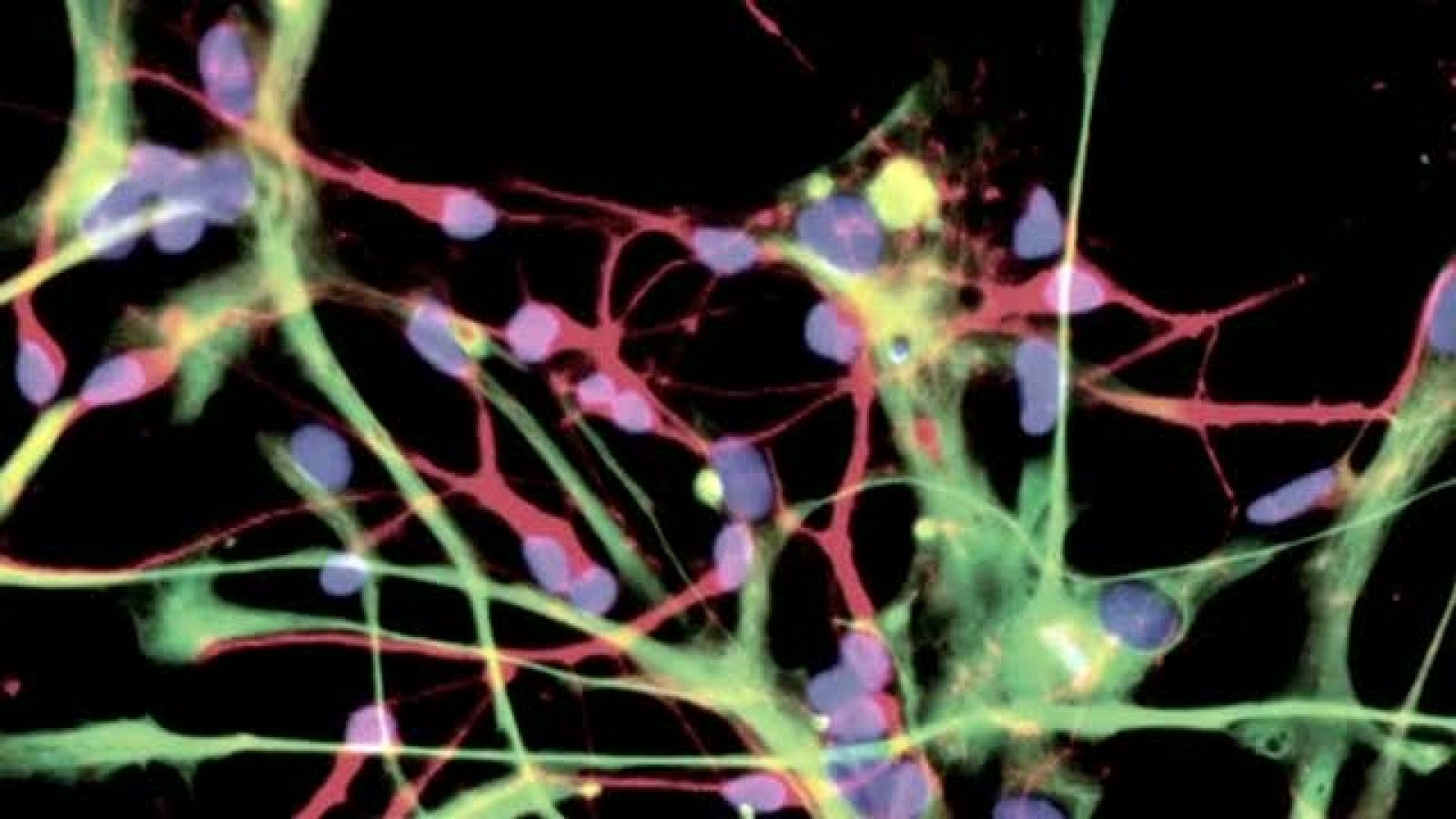 Premios INVI 2011 - eGlía