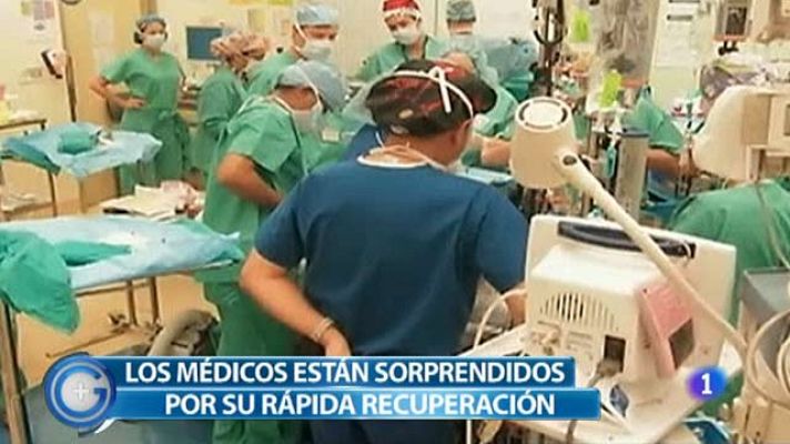 +Gente - Ya no son siamesas