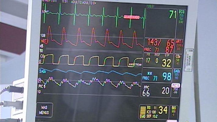 Telediario 1 - El trabajo dentro de la UCI