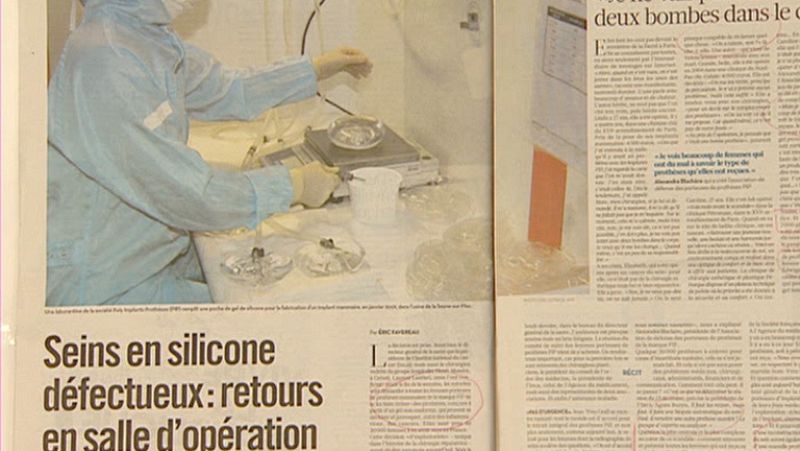 Regreso al quirófano de 30.000 mujeres con implantes mamarios en Francia