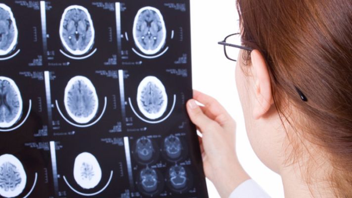 La mañana - Lo que le va bien y mal al cerebro