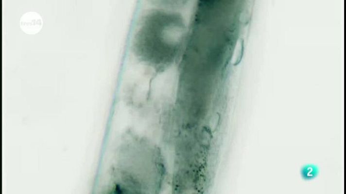 tres14 - fertilidad femenina