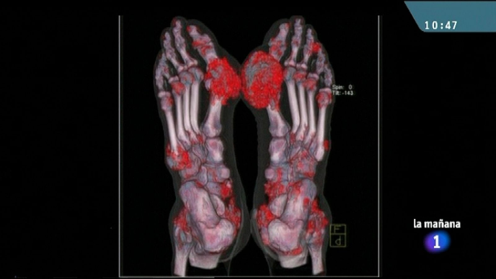 Saber vivir - 28/12/11 - Ver ahora