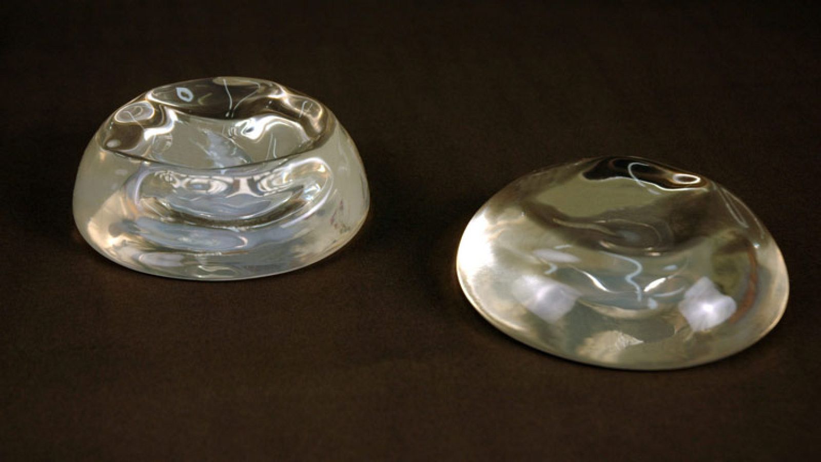 Sanidad ve exagerado obligar a las mujeres a quitarse los implantes mamarios