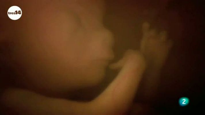 tres14 - Los bebés ya ríen en el vientre