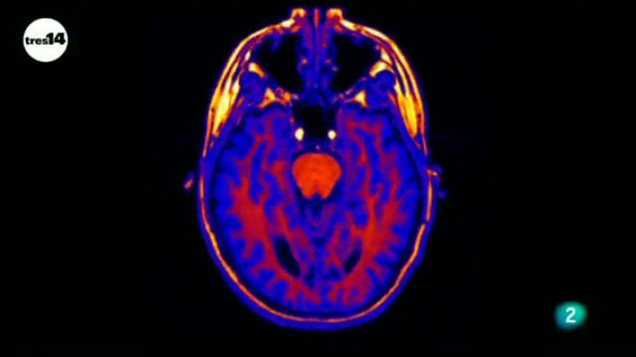 tres14 - El sarcasmo