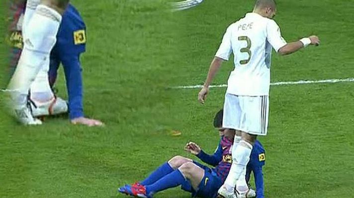 Telediario 1 - La 'Pepe polémica'