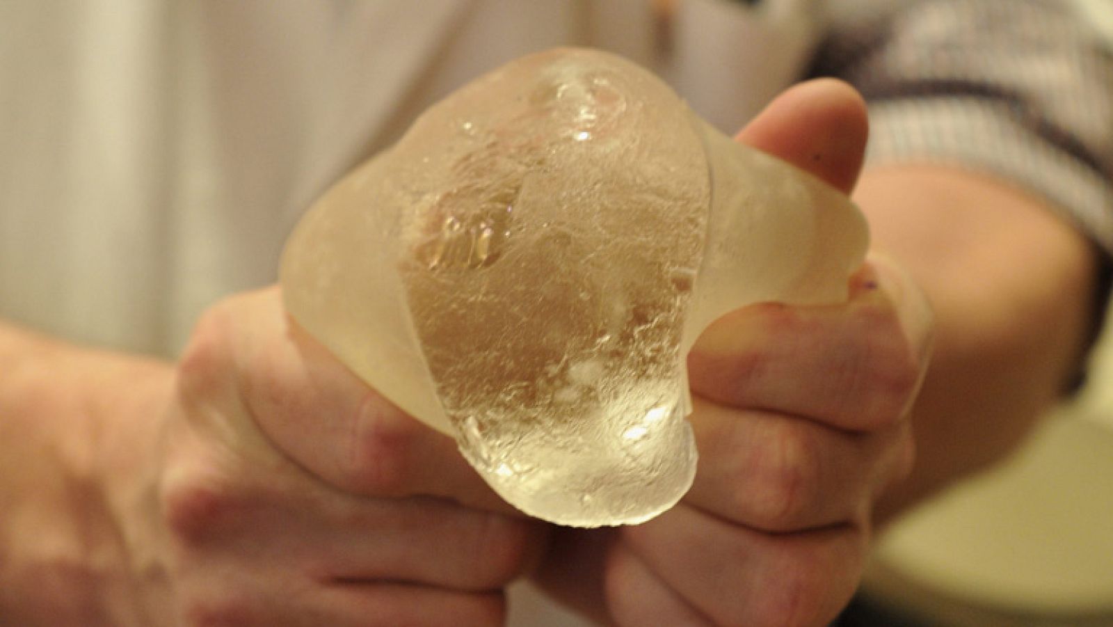 En Sudamérica se han implantado al menos 80.000 prótesis de mama PIP procedentes de Francia