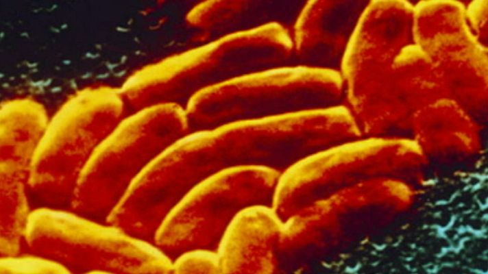 Telediario 1 - Los efectos del cáncer de colon