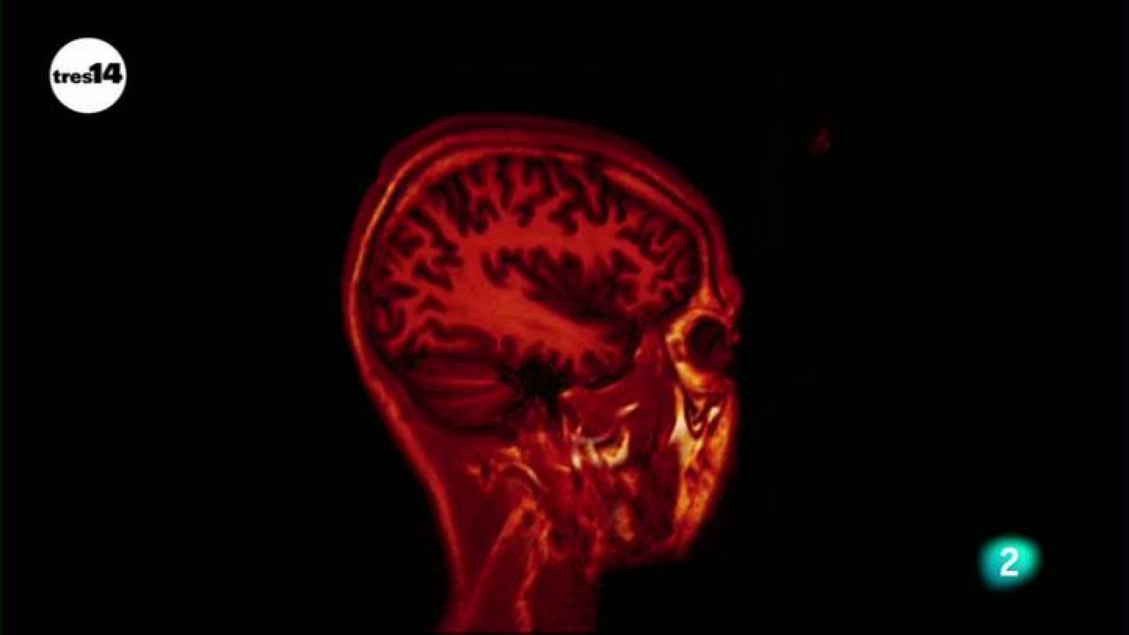 tres14 - Curiosidades científicas - Coeficiente intelectual