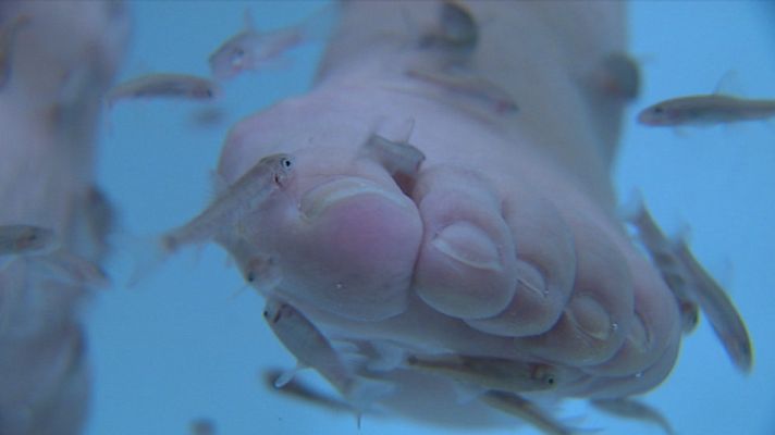 Telediario 1 - Peces peligrosos en podología