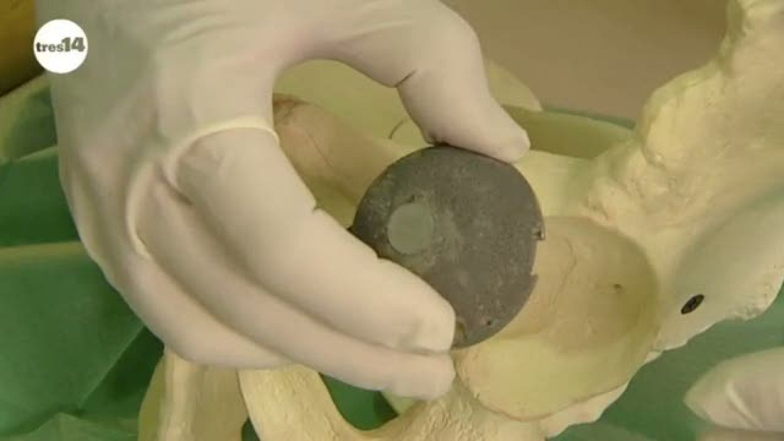 tres14 - Nuevos huesos - avance