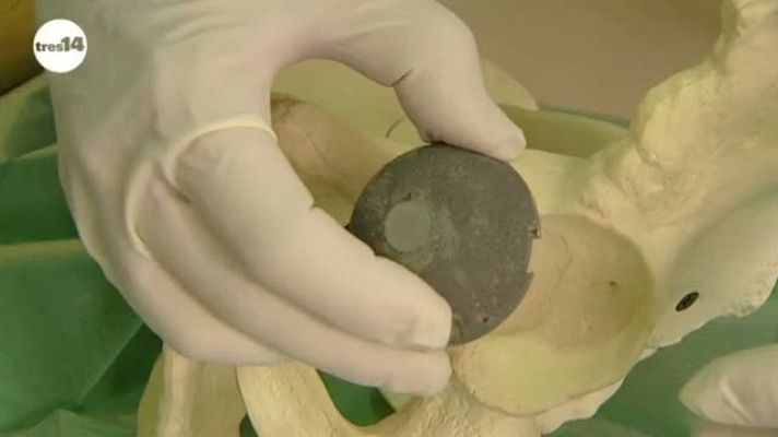 tres14 - Nuevos huesos - avance