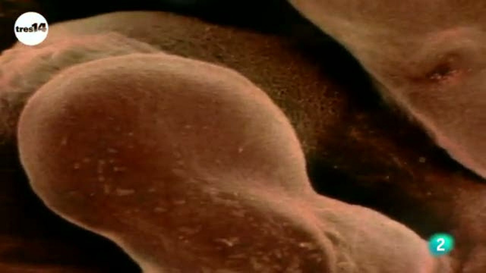 tres14 - Curiosidades científicas -  Los bebés tienen más huesos que los adultos