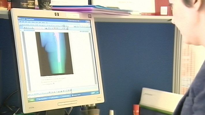 Telediario 1 - Las prótesis de cadera de la empresa Johnson & Johnson, declaradas perjudiciales para la salud