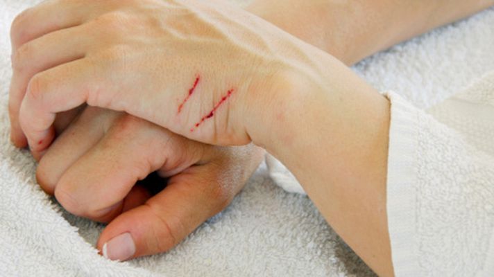 La mañana - Heridas, cicatrices y pié diabético