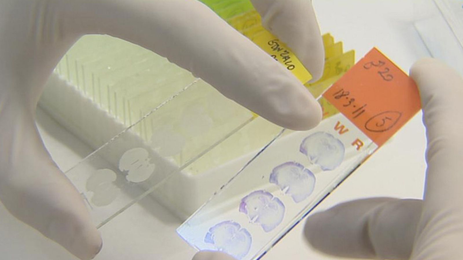 Un tipo de molécula, introducida en el cerebro de ratas, mejora sus conexiones neuronales