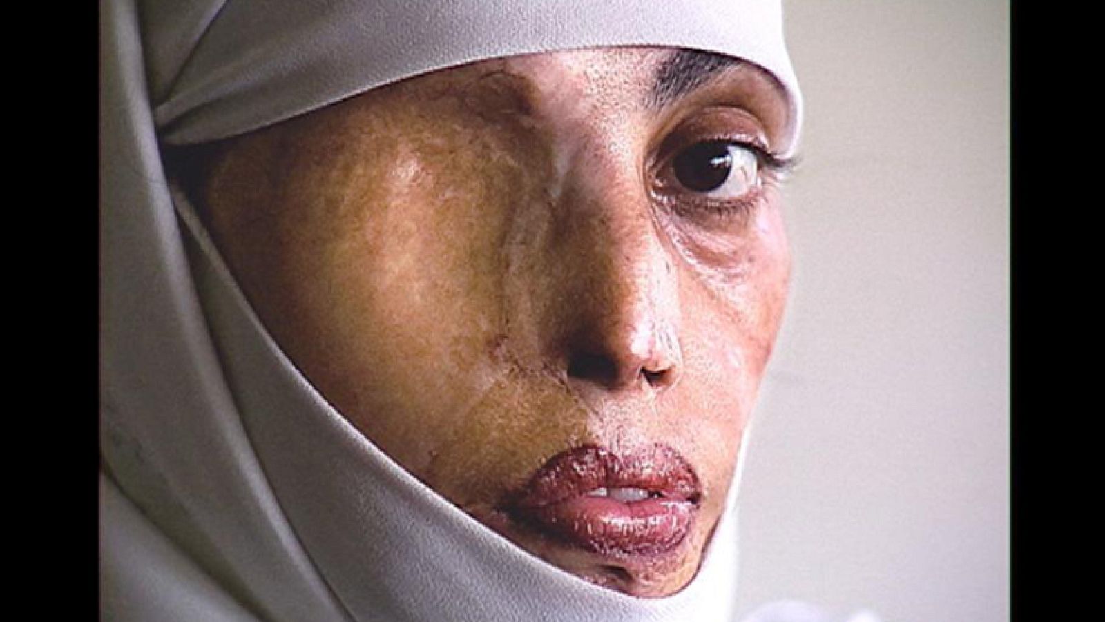 Cinco mil mujeres mueren al año en el mundo