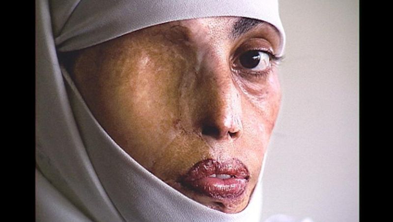 Cinco mil mujeres mueren al año en el mundo