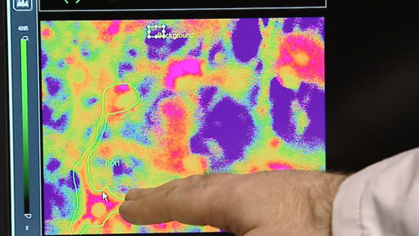 La ansiedad, los medicamentos recetados y la adicción a los mismos