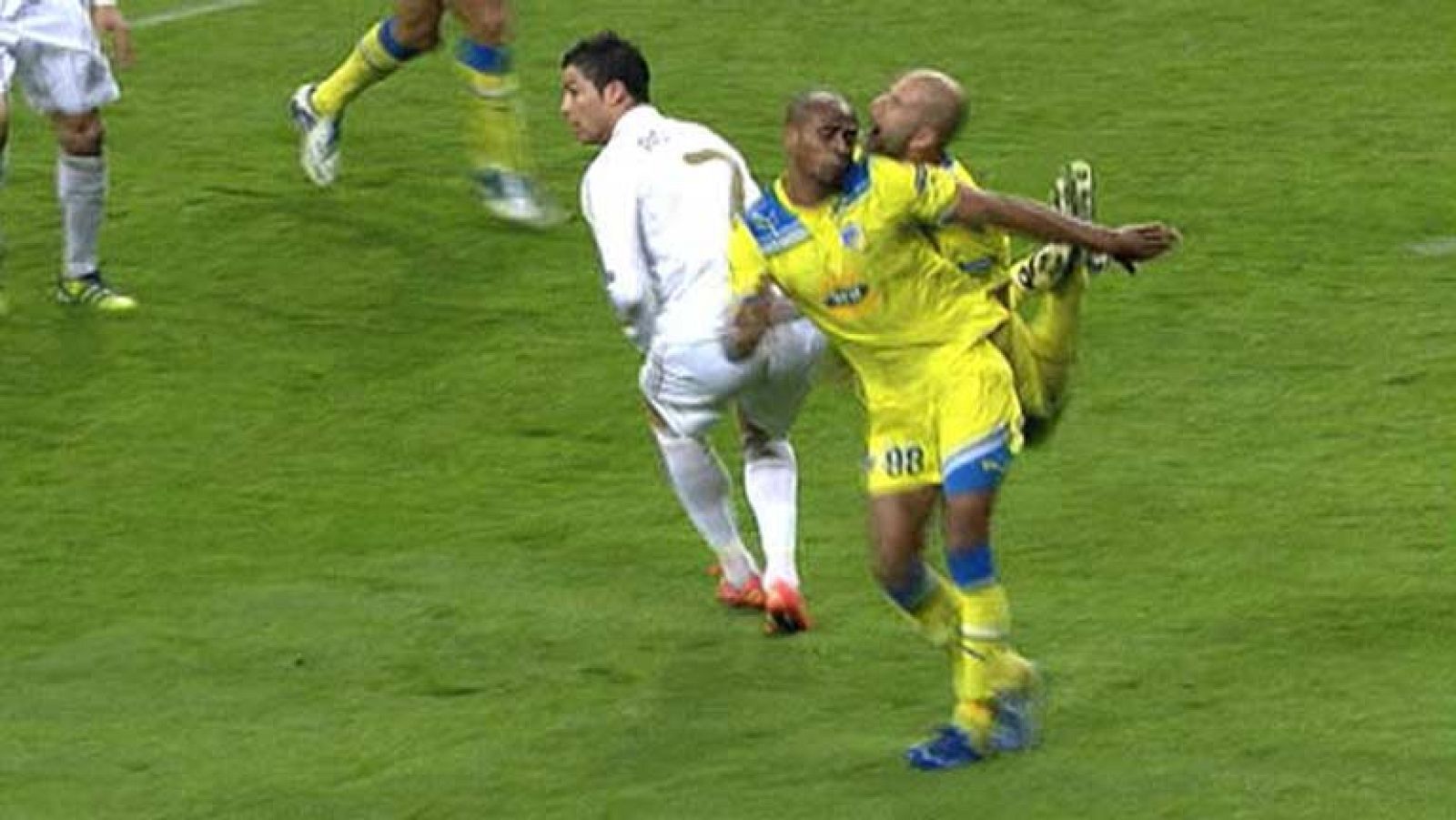 En la segunda parte del Real Madrid-Apoel de Nicosia, el defensa portugués del conjunto chipriota, Paulo Jorge, perdió tres dientes al chocar con su compañero Boaventura.