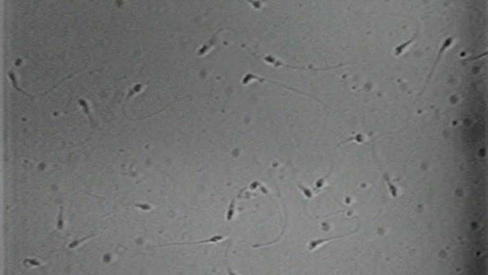 Las donaciones de semen aumentan con la crisis