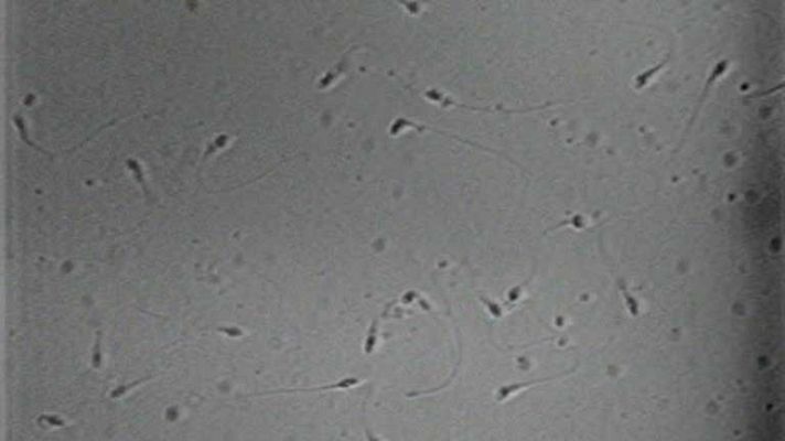 Telediario 1 - Aumentan las donaciones de semen