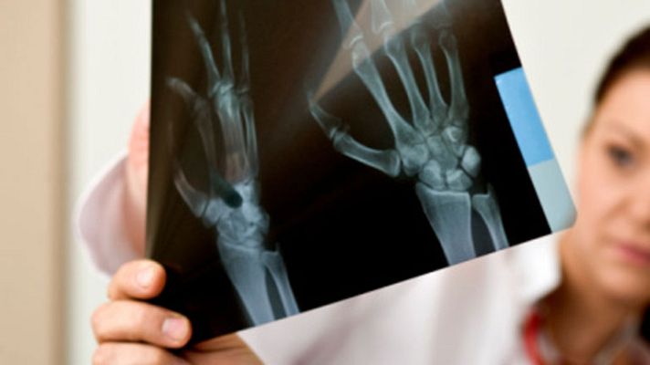 La mañana - Huesos fuertes