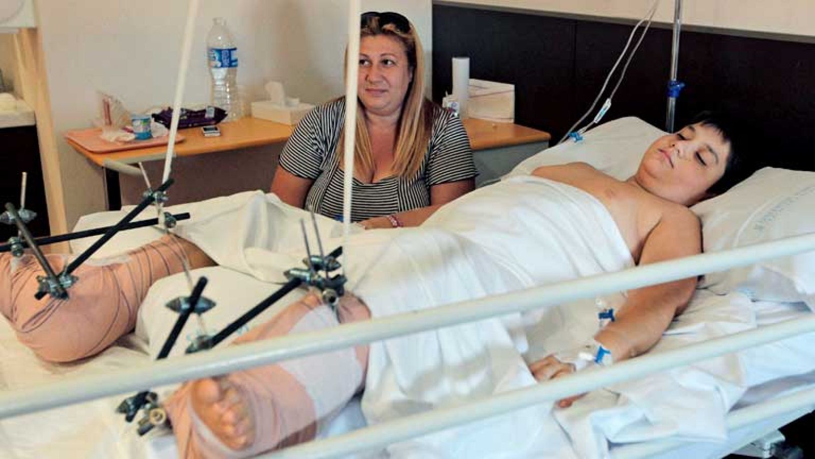 Pedro Cavadas consigue reimplantar a un niño de 10 años sus dos pies