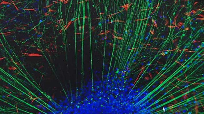 Telediario 1 - De cordón umbilical a neurona