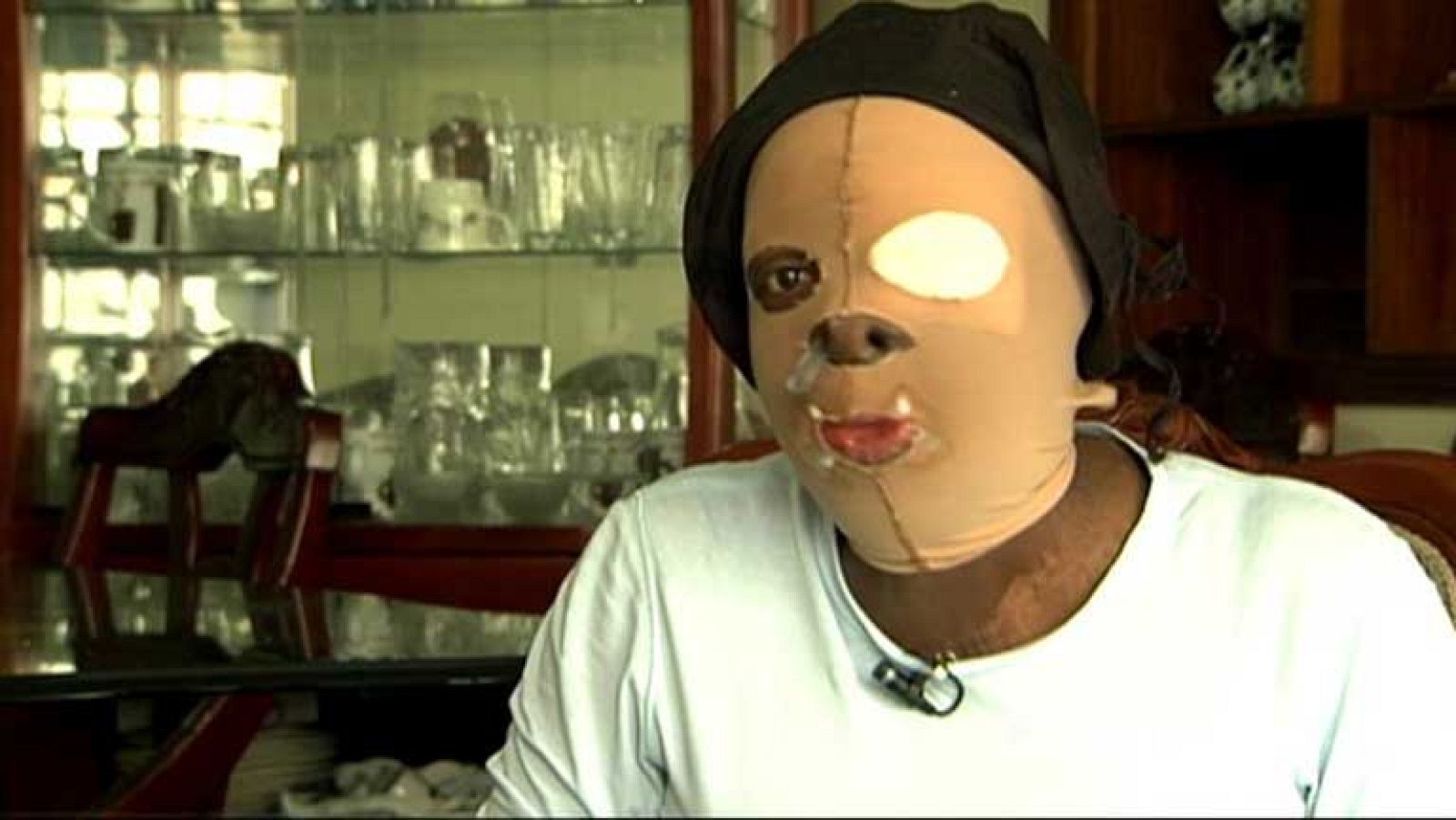 Manifestación en Colombia para que se endurezca la pena por atacar con ácido a mujeres