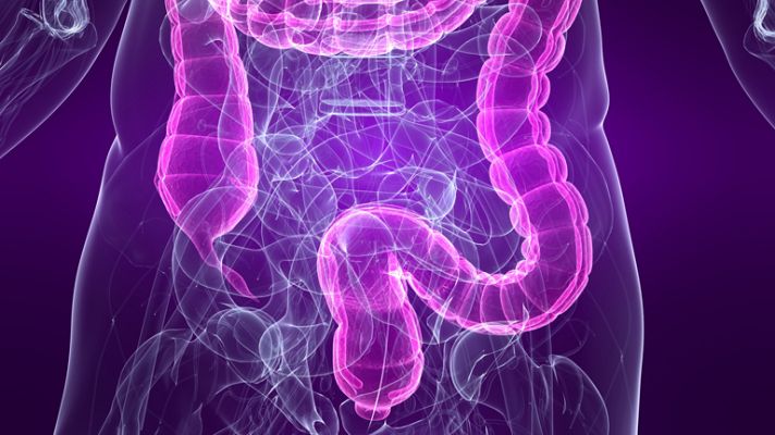 La mañana - Intestino: pólipos y divertículos