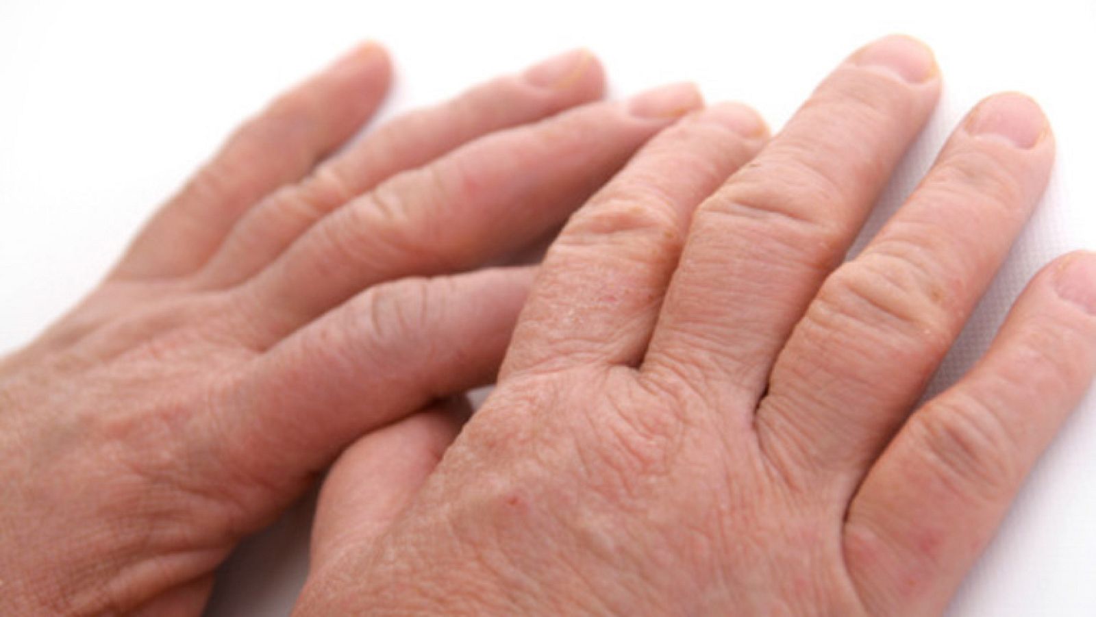 Saber vivir - Retención de líquidos  - Ver ahora