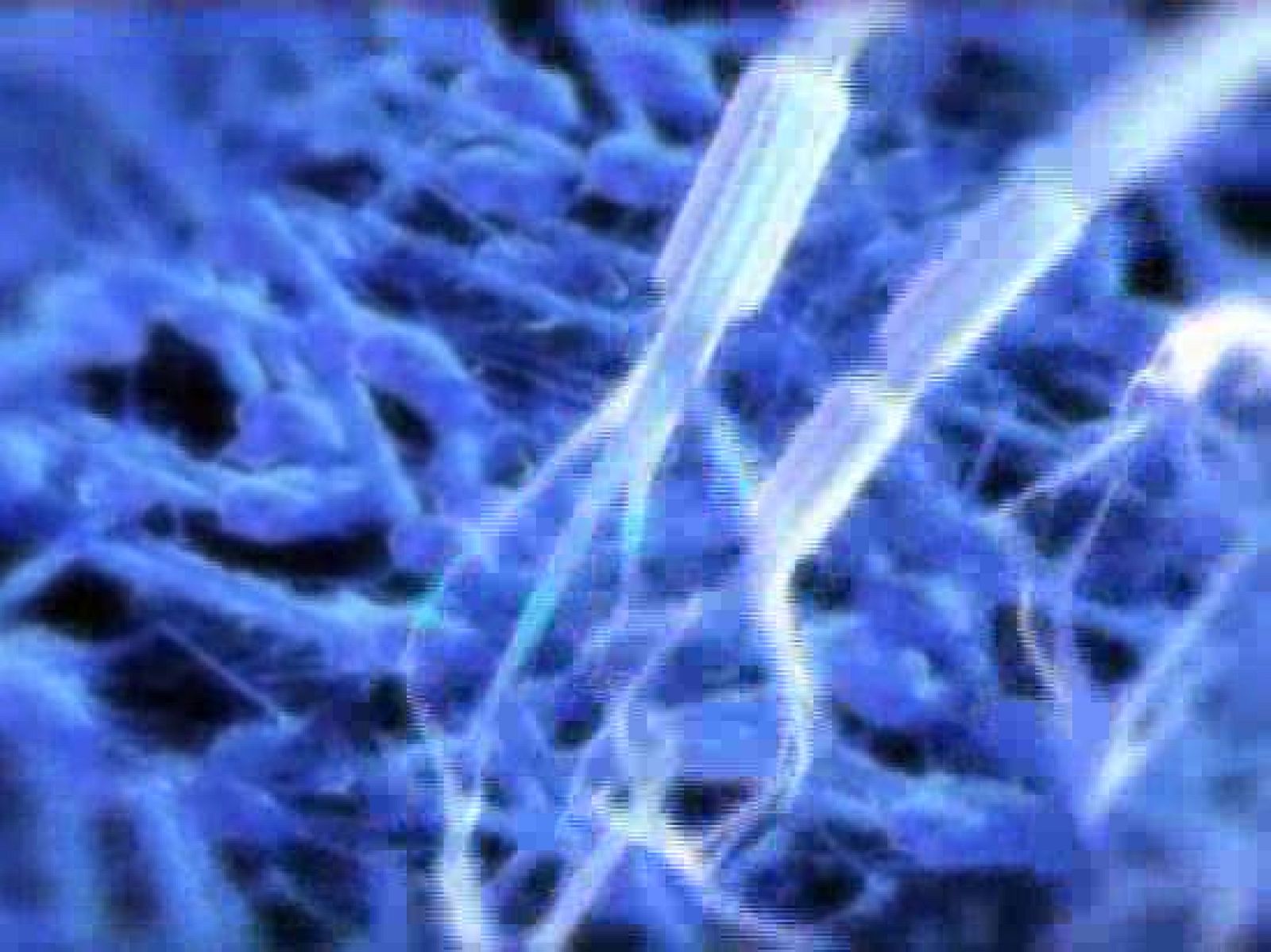 Redes - Punset dialoga con su oncólogo - Redes | Ver