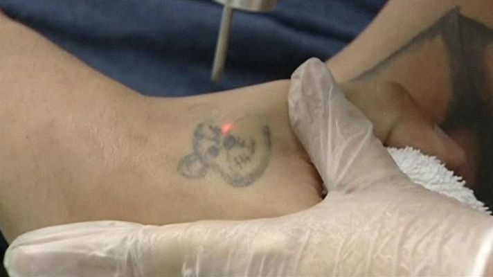 Telediario 1 - Un laser rojo, español