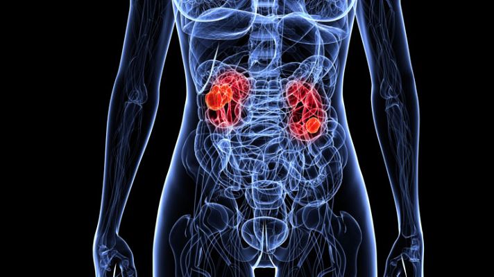 La mañana - Cuida tus riñones