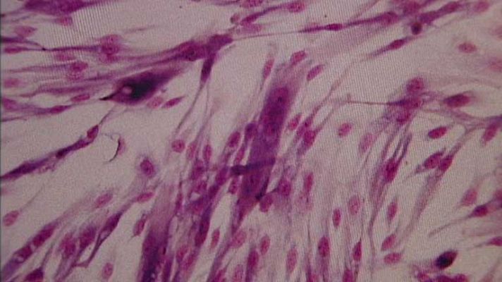 Telediario 1 - Avance científico contra el cáncer